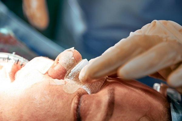 Rhinoplastie lyon : transformez votre nez avec expertise